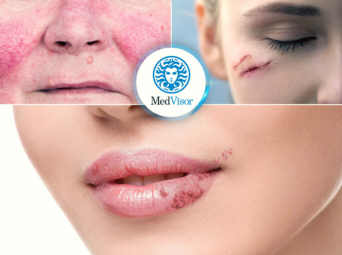 противопоказания для пилинга Избавиться от ожогов салициловой кислотой