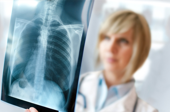 Ингаляции при пневмонии советы пульмонологов