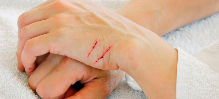 Можно ли мазать солнечные ожоги бепантеном