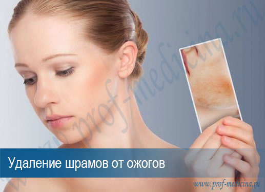 Клиника удаление рубцов от ожога