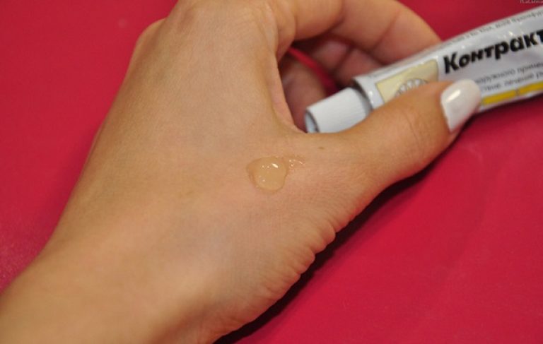 Клиника удаление рубцов от ожога