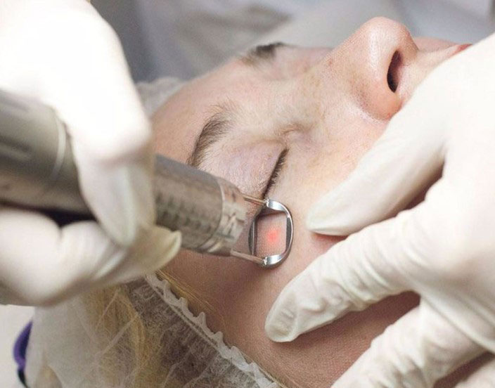 Клиника удаление рубцов от ожога