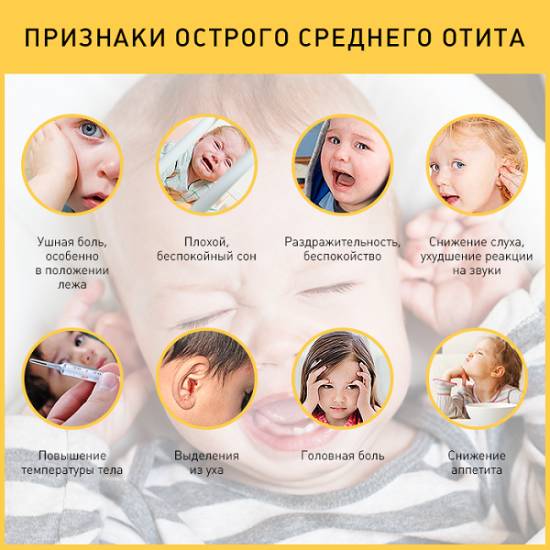 признаки среднего отита