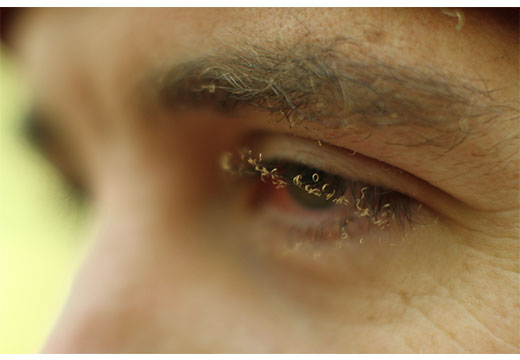 Сгоревшие ресницы