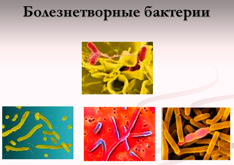 Клебсиелла пневмонии зева, исследуй мазок!