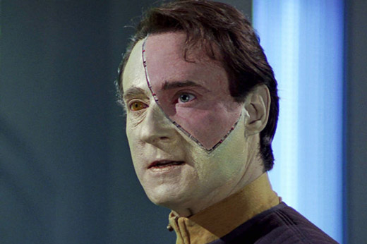 пересадка кожи лица